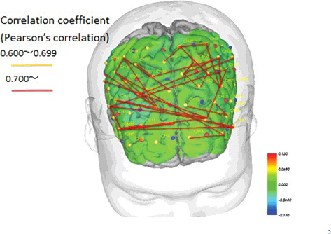 Figure 8. Pre- and post-intervention brain blood flow and correlations between channels in the STT group (p < .05).