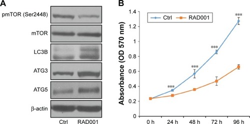 Figure 4 RAD001 inhibits proliferation in progestin-resistant endometrial cancer cells by inducing autophagy.