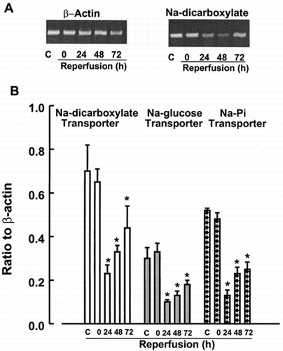 Figure 3. RT-PCR analysis of expression of Na+-cotransporters in kidney cortex. Transcript levels of Na+-dicarboxylate, Na+-glucose and Na+-Pi were analyzed in cortex from control kidneys or kidneys subjected to 0 (ischemia), 24, 48, and 72 h of reperfusion following 60 min of ischemia. Data represent ratio to b-actin signals and are mean ± SE of 3 separate experiments. *p<0.05 compared with the control.