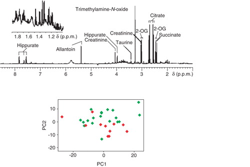Figure 1. The first exemplification of the pharmacometabonomics concept based on pre-dose prediction of toxicity in an animal model. (Top) Typical 1H NMR spectrum of urine before dosing with the toxin galactosamine. (Bottom) A principal components scores plot where each point represents a single rat urine taken before dosing. Red indicates rats that subsequently showed high toxicity and green points are for rats that showed no toxicity. Although there is a partial overlap between the two groups of animals, a clear distinction is observed Citation[4].