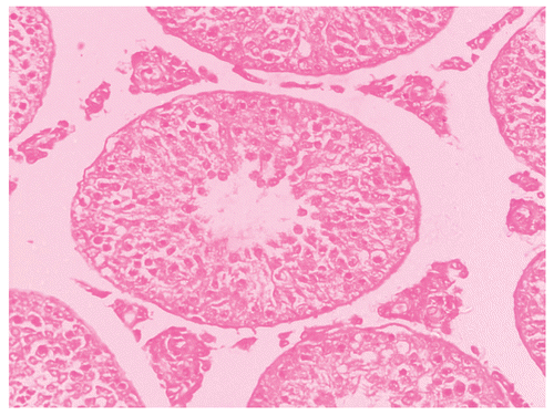 Figure 4.  Showing the section of Rat testis treated with Myristica fragrans Oil at the dose level of 0.4 ml/kg b. wt. for 60 days.