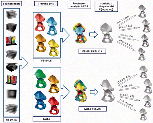 Figure 1. Stages of the gender-specific pelvis SSM generation pipeline. The SSM generation procedure consists of the following consecutive steps: segmentation of pelvic bone structures from the collected CT datasets; generation of the male and female training sets; mesh alignment based on Procrustes analysis; and, finally, application of principal component analysis (PCA) to obtain the gender-specific SSM.
