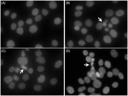 Figure 2. Cell morphology under fluorescence microscopy by Hoechst 33258 staining in HCT-116 cells treated with genistein for 48 h. (A) Control group (0 μM). (B) Treated with genistein (25 μM). (C) Treated with genistein (50 μM). (D) Treated with genistein (100 μM). Arrows indicate the condensed and fragmented nuclei. The images were taken using an Olympus IX71FL fluorescence microscope (Olympus, Tokyo, Japan) (× 400).