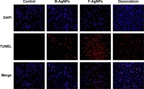 Figure 9 B-AgNPs and F-AgNPs promote apoptosis.Notes: MDA-MB-231 cells were treated with respective IC50 concentrations of B-AgNPs or F-AgNPs for 24 hours. Fluorescent staining of cells was recorded. Representative images are shown for apoptotic DNA fragmentation (red staining) and corresponding nuclei (blue staining).Abbreviations: B-AgNPs, bacterium-derived AgNPs; DAPI, 4′,6-diamidino-2-phenylindole; F-AgNPs, fungus-derived AgNPs; IC50, half-maximal inhibitory concentration; TUNEL, terminal deoxynucleotidyl transferase dUTP nick end labeling.