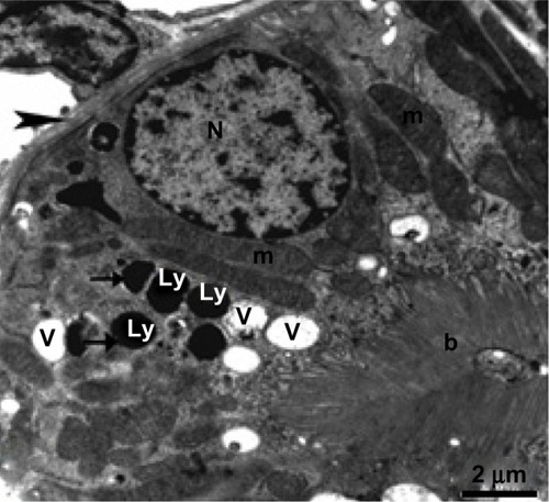 Figure 7 Transmission electron micrograph of kidney tubular epithelium from the treated group showing the nucleus, numerous vesicles, and mitochondria with cristae. The lysosomes are filled with electron-dense nanoparticles varying in size and shape (arrow). Note that the tubular epithelium is lying on a thickened basement membrane (arrow head) and its free surface has a long brush border. Scale bar 2 μm.Abbreviations: b, brush border; Ly, lysosomes; m, mitochondria; N, nucleus; V, vesicles.