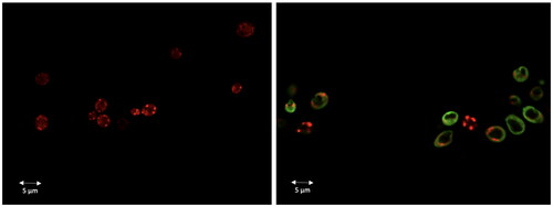 Figure 11. Dec-1B localisation in C. albicans cells detected by CLSM. Dec-1B conjugated with 5(6)-carboxyfluorescein is coloured in green, while the mitochondria are visualised in red by MitoTracker. The images show C. albicans cells before treatment (left panel) and after treatment for 30 min with Dec-1B (right panel) with the green signal localised on the surface.
