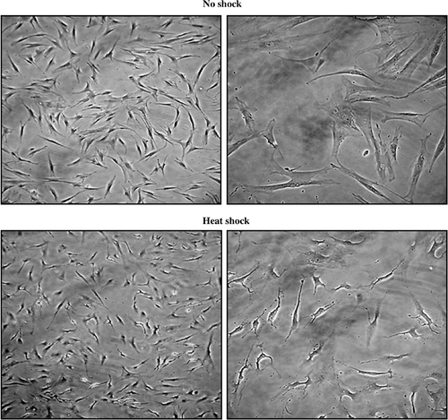 Figure 1. Microscopic analysis of untreated and heat-treated MSCs. MSCs were untreated (no shock) or were heat-treated at 43°C for 45 min, followed by incubation at 37°C for 24 h (heat shock). Microscopic observation was performed by phase-contrast microscopy with 10 (left) or 40 (right) fold of magnification. A representative image is displayed from three independent experiments.