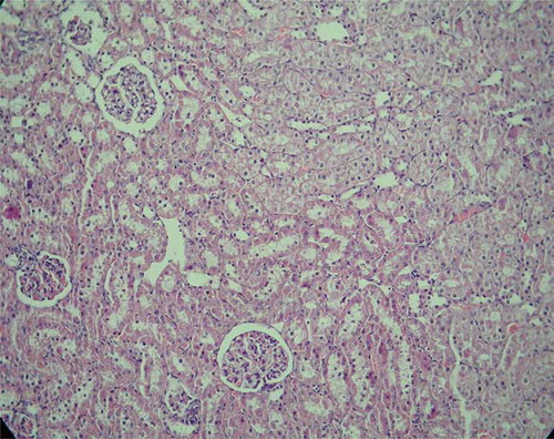 FIGURE 1.  Normal renal tissue with no pathological change from control group.