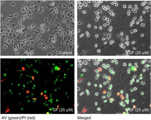 Figure 5 Effect of GF (25 μM) on PANC-1 cell morphology after 8 hours in N Phase-contrast (upper left), fluorescent (lower left), and merged (lower images of PANC-1 cells.