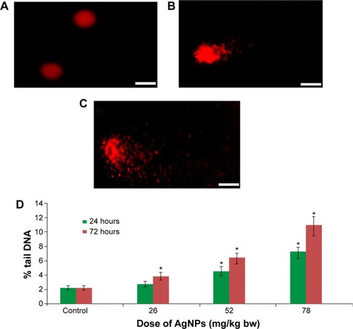 Figure 5 DNA damage in lymphocytes of Swiss albino mice after exposure to AgNPs.