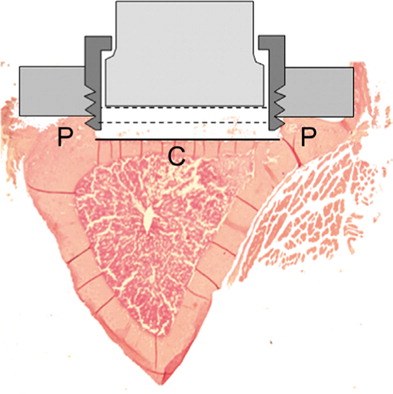 Figure 2. Transverse section of proximal tibia. The original plug protruded 0.1 mm deeper than the piston (the black line). The lowest position for the piston is 0.6 mm from the bone surface (the middle dotted line). The highest position is 1.4 mm from the bone surface, (the upper dotted line). Thus, a total volume of 8.6 mm3 under the piston, reduced to 4.5 mm3 when the piston is moved to the lower position during a pressure cycle.