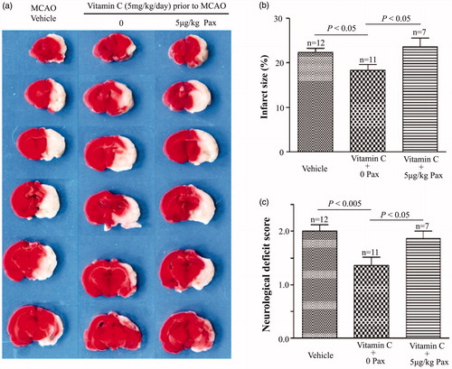 Figure 8. BKCa channel blocker paxiiline (Pax) suppresses the effect of vitamin C on MCAO rats. (a) Representative images of brain slices for vehicle-treated MCAO rats and vitamin C pretreated (5 mg.kg−1.day−1 for three weeks prior to MCAO) MCAO rats at 24 hr post-MCAO in the absence and presence of Pax (5 μg.kg−1). (b,c) Bar graphs showing relative infarct size (b) and neurological deficit score (c) in vehicle-treated and vitamin C pretreated MCAO rats at 24 hr post-MCAO in the absence and presence of Pax.