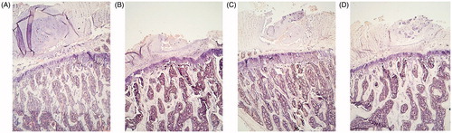 Figure 11. Hematoxylin eosin staining 100×. Trabecular component of the L4 vertebrae. Sham-operated rats (SHAM) (A) and orchidectomized rats (ORX) (B) as baseline and castrated rats treated with 10 mg/kg/twice a week of OPG–Fc (ORX + OPG–Fc) (C) or testosterone cypionate (1.7 mg/kg/once a week) (ORX + testosterone) (D). Greater magnification allowed us to better visualize the increase in trabecular thickness in the group of rats treated with testosterone.
