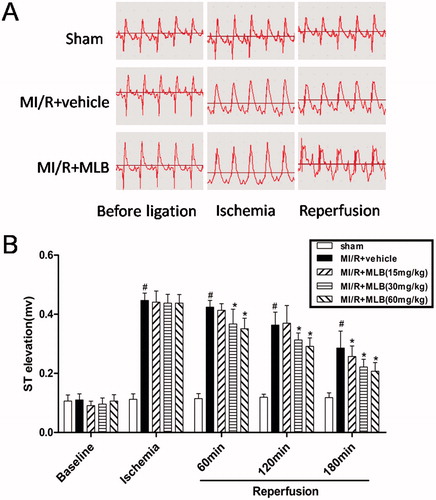 Figure 2. Effect of MLB on ST elevation. (A) Electrocardiogram observation during the course from anesthesia (before ligation), ischemia to reperfusion. (B) Effect of MLB on ST elevation. Myocardial ischemia/reperfusion; MLB, magnesium lithospermate B. n = 8; values are expressed as the mean ± S.D. Significance was determined by ANOVA followed by Tukey’s test. #p < 0.05 versus Sham group; *p < 0.05 versus MI/R + vehicle group.