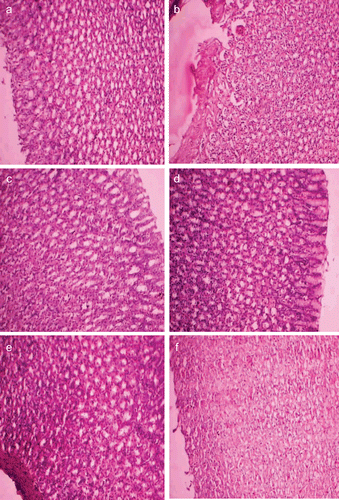Figure 3.  Histopathological studies of dexibuprofen and its prodrugs on rat stomach.