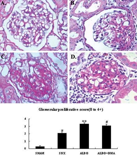 Figure 1.  Photomicrographs of glomeruli (A–D). Glomerular proliferation was evaluated as described as E. In renal ablation rats, glomerular sclerosis was dramatically more serious than that of the SHAM group (B vs. A). Rats that received aldosterone infusion exhibited more serious glomerular sclerosis than the 5/6 nephrectomy rats (C vs. B). Treatment with DMA significantly attenuated aldosterone-induced glomerular injury (D). A: SHAM group; B: SNX group; C: ALDO group; D: ALDO+DMA group. *p < 0.01 versus SHAM group; **p < 0.01 versus SNX group; #p < 0.01 versus ALDO group. Magnification: ×400, PAS staining.