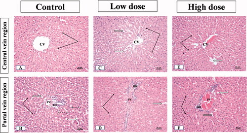 Figure 5. Illustrative photographs displaying the effect of low and high doses (100 and 200 mg/kg, respectively). MgO-zein nanowires on liver histopathology in female rats (H & E stain × 200). Control group (A,B) showed (A) normal central vein (CV), hepatocyte cell cords (black arrows), cell nuclei are rounded and vesicular; (B) normal portal vein (PV). Low dose group (C,D) showed (C) normal hepatocytes cell cords with their rounded active vesicular nuclei (black arrows); (D) portal regions (PV) showed slight congestion of blood portal veins, normal bile ducts, and connective tissue. High dose group (E,F) showed (E) hepatocytes with slightly small nuclei and condensed chromatin at central vein region (black arrows); (F) hepatocytes with slightly small nuclei and condensed chromatin at portal veins (PV) regions (black arrows).