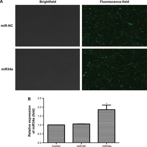 Figure 8 Overexpression of miR34a by lentivirus vector transfection.Notes: BEAS-2B cells were transfected by lentivirus vectors with hsa-miR34a or empty lentiviral vectors for 72 hours. As shown in the pictures, the ratio of GFP expression was up to 80%, meaning that transfection efficiency was appropriate (A). We detected the expression of miR34a by real-time PCR, and the result showed that miR34a was successfully upregulated (B). *P<0.05, miR34a compared with miR-NC. Data are expressed as mean ± SD; n=3.Abbreviations: GFP, green fluorescent protein; miR34a, microRNA 34a; miR-NC, microRNA negative control; SD, standard deviation.