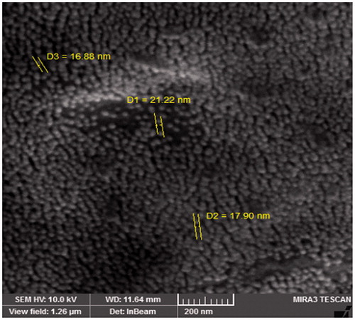 Figure 2. Nanoencapsulated chrysin in scanning electron microscopy micrograph. SEM shows the particle size range between 40 and 75 nm.