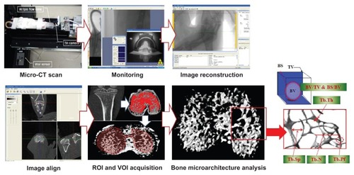 Figure 1 Assessments of alterations in trabecular bone microarchitecture using microcomputer tomography scanning, monitoring, image reconstruction, image alignment, ROI and VOI acquisition, and three-dimensional analyses.