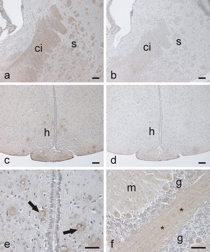 Figure 5.  Immunostaining of CA III in the mouse brain. In the cerebrum, the capsula interna (a) shows moderate positive reaction, while the control staining is negative (b). (ci, capsula interna; s, striatum). Some neurons in the hypothalamic region are stained (c) (h, hypothalamus). Control shows no reaction (d). (e) A higher-magnification image in which the CA III-positive staining in the hypothalamic neurons (arrows) is seen more clearly. In the cerebellum (f), some neuronal axons and the Purkinje cells are positively stained. (m, molecular layer; g, granule cell layer; *, neuronal axons). Bars 50 µm.