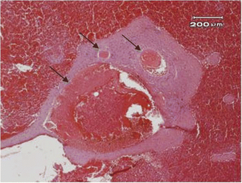 Figure 6. The blood vessels (arrow) near the resected margin of the spleen showed thrombus formation (40×).