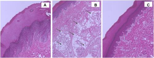 Figure 5 Light photomicrographs of morphology of rat’s skin after application of (A) control plain gel, (B) free DFZ gel and (C) optimized DFZ-UENVs gel.