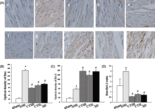 Figure 5.  Expression of Bax and Bcl-2 proteins in myocardium. (A) Representative immunostaining for Bax and Bcl-2 proteins in myocardium in rats (×400). (a), (b), (c), (d), (e), (f), (g), (h), (i), and (j) correspond to groups: (a) control group for Bax; (b) AMI group for Bax; (c) CTIH group for Bax; (d) CTIL group for Bax; (e) XD group for Bax; (f) normal group for Bcl-2; (g) AMI group for Bcl-2; (h) CTIH group for Bcl-2; (i) CTIL group for Bcl-2; (j) XD group for Bcl-2; (B) Semi-quantitative analysis of the optical density of Bax; (C) Semi-quantitative analysis of the optical density of Bcl-2; (D) The calculated Bax/Bcl-2 ratio. Values are shown as mean ± SD (n = 8). Compared with sham: *p < 0.05. Compared with AMI: #p < 0.05.