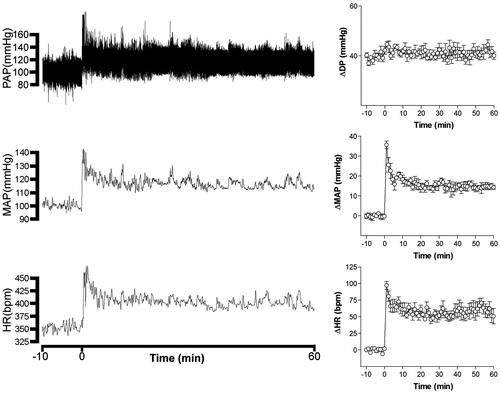 Figure 1. On the left – Recordings of pulsatile arterial pressure (PAP), mean arterial pressure (MAP), and heart rate (HR) of one unanesthetized rat submitted to restraint showing the cardiovascular changes observed during a restraint period of 60 min. On the right – Curves showing changes with time of differential pressure (systolic – diastolic pressure, ΔDP), mean arterial pressure (ΔMAP) and heart rate (ΔHR). The onset of restraint is at t = 0.