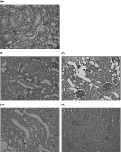 Figure 8. Panel D shows the normal tubulointerstitial structure of vehicle-treated rat kidneys. Panels E and F show prominent interstitial damage, tubular hypertrophy, inflammatory cell infiltration, and thickening of tubular basement membrane in the STZ diabetic control rats. Panels G and H from polyphenolic extract-treated rat kidney show improved structure of tubulointerstitial with minimal injury.