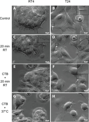 Figure 1 Phase-contrast microscope images of RT4 and T24 cells treated with either cholera toxin B (CTB) or temperature. Images of RT4 A) and T24 B) cells growing in normal conditions without any treatments (control experiments). Note that intercellular membrane nanotubes (ICNs) are not present between RT4 cells, while a few are present between T24 cells (arrow). Following their growth in normal conditions, the cells are moved to room temperature (RT) for 20 minutes, showing no significant change in the morphology of RT4 cells C), while T24 cells become more separated D). In conjunction with 20 minutes at RT, cells are treated with CTB. Note that in RT4 cells E) no ICNs are observed, while many ICNs (arrow) are present between T24 cells F). Finally, the combination of CTB and temperature incubation at 37°C induces rounding of RT4 cells and their detachment G), while T24 cells demonstrate large numbers of ICNs H).