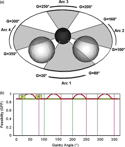 Figure 3.  Selection of arcs for the test case. (a) Irradiation with four coplanar arcs, where both OARs have the same importance factor of 1. A minimum GFF value of 0.9 and a minimum arc length of 10° have been selected as selection criteria. The arcs selected by the system are represented as semi-transparent gray fans: 20°–80°, 100°–160°, 200°–250° and 300°–350°. (b) GFF feasibility graph for the selected of arcs. The starting and finishing angles of the arcs are represented as vertical lines superimposed on the GFF graph, while the minimum GFF value is represented by the horizontal bar. The system selected results can be altered by changing the bar's location using the mouse.
