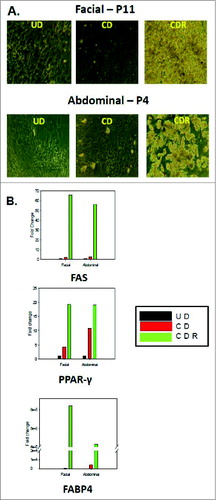Figure 3. Morphology and gene expression of adipogenic markers in facial and abdominal preadipocytes. Facial and abdominal preadipocytes were grown for 14 d in the CD media or CDR media. (A) Images are representative of four individual experiments. (B) Gene expression was evaluated by qPCR and normalized by expression of the RPL13A gene. UD, undifferentiated (cultured in growth medium); CD, control differentiation; CDR, CD + 10 μM rosiglitazone; FABP4, fatty acid binding protein 4; FAS, fatty acid synthase; P, passage number; PPAR-γ, peroxisome proliferator-activated receptor gamma; qPCR, quantitative polymerase chain reaction.