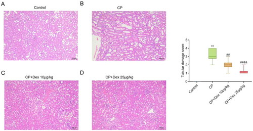 Figure 2. Effect of dexmedetomidine on the histopathology of kidney tissue in rats treated with cisplatin. Pathological changes in the kidney tissue of acute kidney injury rats were detected using hematoxylin and eosin staining. A, Representative pathology images of kidneys in the control (A), CP (B), CP + Dex 10 μg/kg (C), and CP + Dex 25 μg/kg groups (F = 65.67). ** p < 0.01 vs. Control group; ## p < 0.01 vs. CP group; & p < 0.01 vs. CP + Dex 10 μg/kg.