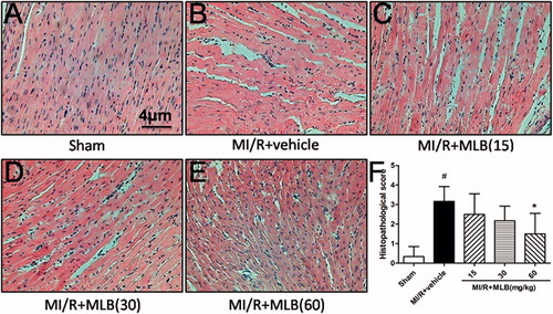 Figure 5. Histopathological changes in rat cardiac tissue (H&E × 400). (A) Sham group, (B) MI/R + vehicle group, (C) MI/R + MLB (15 mg/kg) group, (D) MI/R + MLB (30 mg/kg) group, (E) MI/R + MLB (60 mg/kg) group, (F) Histopathological scores. MI/R, myocardial ischemia/reperfusion; MLB, magnesium lithospermate B. n = 8; values are expressed as the mean ± S.D. Significance was determined by ANOVA followed by Tukey’s test. # p < 0.05 versus Sham group; *p < 0.05 versus MI/R + vehicle group.