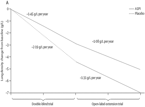 Figure 3. Disease modification in the RAPID and RAPID Extension trials Citation(10). Graph showing the annualised rate of decline in physiologically adjusted P15 (g/L) at TLC over 48 months (ITT population). Reprinted from The Lancet, Vol 386. Chapman, KR et al., Intravenous augmentation treatment and lung density in severe α1 antitrypsin deficiency (RAPID): a randomised, double-blind, placebo-controlled trial, pp. 360–368. Copyright (2015), with permission from Elsevier.