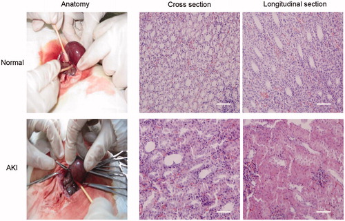 Figure 5. Construction of the AKI models. Notes: The upper panel showed the uninjured kidney, the lower panel showed the injured kidney after ischemia–reperfusion. The mid and right panel showed that Renal tubular endothelial cells edema, necrosis, and arrangement disorder. Scale bar, 30 μm.