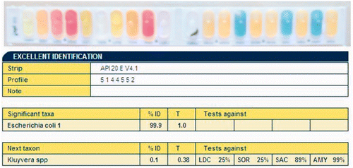 Figure 7. Bacterial biochemical tests were performed by an API 20E kit, and positive or negative results as judged by colour were input into the API web software system and analysed, which revealed that all the characteristics were 99% specific to Escherichia coli.