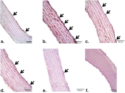 Figure 5. Representative photomicrographs of PAR (a–f) immunohistochemistry in controls (a), ET-1-incubated (b), ET-1 and PEG-SOD plus apocynin-incubated (c), ET-1 and PJ34-incubated (d), and PJ34-incubated vessels (e). Strong immunostaining of PAR was observed in ET-1-incubated endothelial cells (arrows). Expression of PAR was minimal in both ET-1 and PEG-SOD plus apocynin-incubated, and ET-1 and PJ34-incubated vessel endothelium. Negative control sections with PAR (f) primary antibodies. Note the absence of PAR immunostaining. Original magnifications ×50.