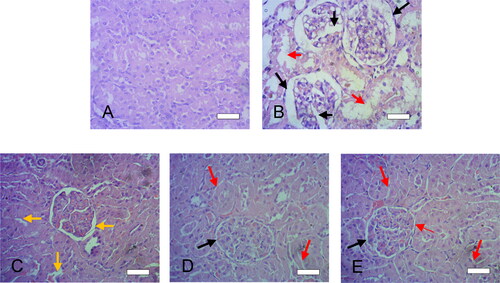 Figure 9. Histological features of liver sections after cisplatin challenge with or without oral administration of crystalline TQM (10 mg/kg, p.o.) or SMSD-TQM (10 mg-TQM/kg, p.o.). (A) Rats treated with saline, (B) cisplatin-treated rats, (C) cisplatin-treated rats with crystalline TQM, (D) cisplatin-treated rats with SMSD-TQM/RVD and (E) cisplatin-treated rats with SMSD-TQM/FD. Each bar represents 50 µm.