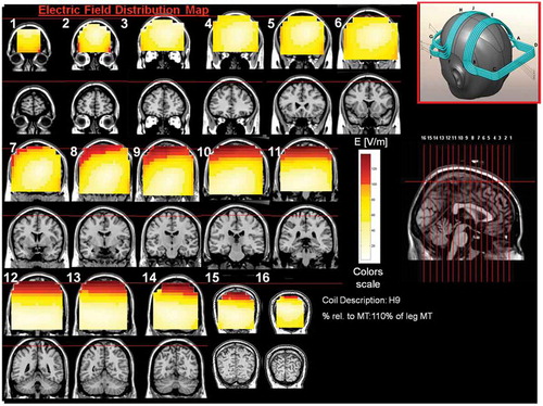 Figure 10. Colored field maps for the H9-coil indicating the absolute magnitude electrical field in each pixel at 110% of foot motor threshold, for 16 coronal slices 1 cm apart. Red pixels indicate regions with field intensity above the threshold for neuronal activation. Full color available online.