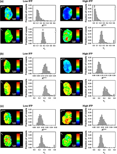 Figure 2. The Ktrans image, Ktrans frequency distribution, ve image, and ve frequency distribution of an A-07 tumor with low IFP (left) and an A-07 tumor with high IFP (right) imaged with Gd-DTPA (a), P846 (b), or gadomelitol (c).