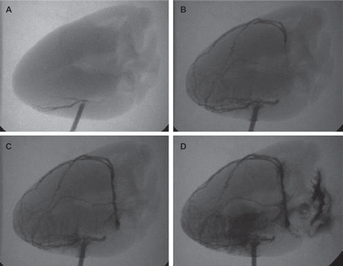 Figure 2. Blood vessel imaging. The imaging agent could diffuse into the myocardial tissue through middle cardiac vein, and flow back to right atrium through contralateral coronary vein.