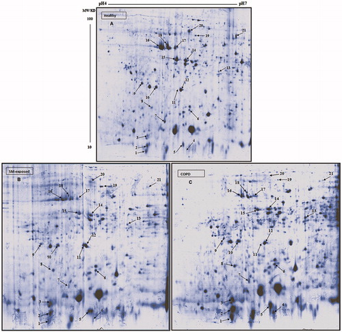 Figure 1. Representative 2-D protein patterns of PMN from study subjects. (A) Healthy control. (B) COPD patient. (C) SM-exposed subject. Sample preparation and 2-D analysis was performed as described in Materials and methods. Proteins (500 µg/subject) were separated first using linear IPG strips (pH 4–7) followed by 12% SDS-PAGE. Protein spots were then visualized by colloidal CBB staining.