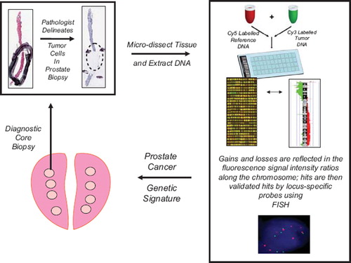 Figure 1. Flow diagram of array CGH technology for determining sub-chromosomal losses and gains within the prostate cancer genome (see text for details). Areas of tumor tissue are micro-dissected within pre-treatment biopsies based on a pathologist's markings. DNA is then extracted from the dissected tissue and subjected to aCGH hybridization. The aCGH “hits” are defined by fluorescence-based, image analysis software. Allelic losses and gains can be validated within the same patient's tissues, or amongst groups of patients, using loci-specific fluorescent-in-situ-hybridization (FISH). The final aCGH validated “hits” can be compared between responders and non-responders to radiotherapy to develop novel prognostic and predictive factors.