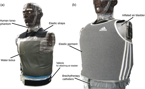 Figure 4. Human torso CT phantom fitted with a conformal ‘L’ applicator in preparation for CT imaging and evaluation of applicator conformity. (a) Waterbolus layer fitted on phantom with elastic straps; (b) complete applicator fitted on phantom with inflated air bladder and an elastic garment.