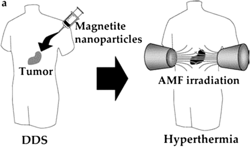 Figure 10. Hyperthermia using magnetite nanoparticles. Scheme of hyperthermia treatment. Magnetite nanoparticles are concentrated in tumor tissue by the DDS.