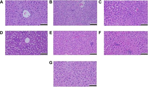 Figure 6 Microphotographs of hematoxylin and eosin stained liver tissue.