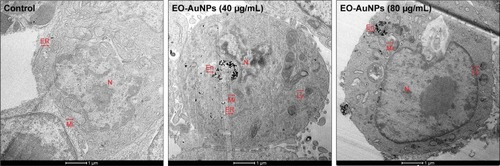 Figure 5 Intracellular localization of EO-AuNPs in RAW 264.7 cells observed by a transmission electron microscopy (TEM). Cells were treated with EO-AuNPs (40 and 80 µg/mL) for 3 hours and then were fixed and examined by TEM (scale bar =1 µm). EO-AuNPs are distributed in the membrane-bound compartments, resembling endosomes or lysosomes.Abbreviations: N, nucleus; Mi, mitochondria; ER, endoplasmic reticulum; En, endosome; Ly, lysosome; EO-AuNPs, Euphrasia officinalis-gold nanoparticles.