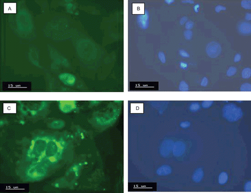 Figure 13.  Confocal microscopy images of Caco-2 cells after nuclei staining: control under filter for green (a) and blue fluorescence (b); Caco-2 cells incubated at 37°C with the sample A1F under filter for green (c) and blue fluorescence (d).